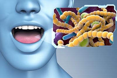 An image featuring a person s face with an open mouth, superimposed on a background that includes a close-up of bacteria and a text bubble with the word  VIRUS .