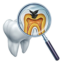 An illustration of a magnified human tooth with an internal view showing the root and pulp chamber, viewed through a magnifying glass lens.