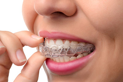 A person is holding a toothbrush in their hand and wearing braces on their teeth.