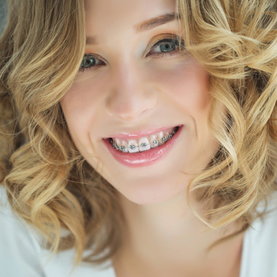 A young woman with braces smiles at the camera, showcasing her smile and the braces.
