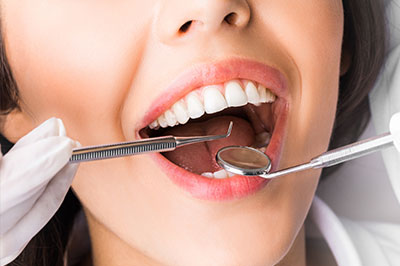 A woman with a wide smile is seated in front of a dental professional, who appears to be performing oral care procedures on her teeth.